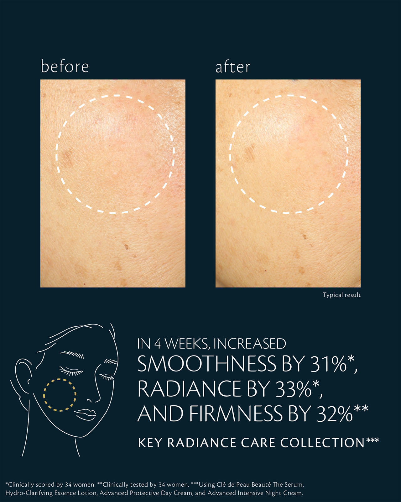 Photo of before-and-after comparison of skin condition with KEY RADIANCE CARE COLLECTION. The left image shows the cheek area before use, with uneven texture and dryness. The right image shows the cheek area after 4 weeks of use, with smoothness improved by 31%, radiance by 33%, and firmness by 32%, based on a clinical test of 35 women using The Serum, Hydro-Clarifying Essence Lotion, Advanced Protective Day Cream, and Advanced Intensive Night Cream.