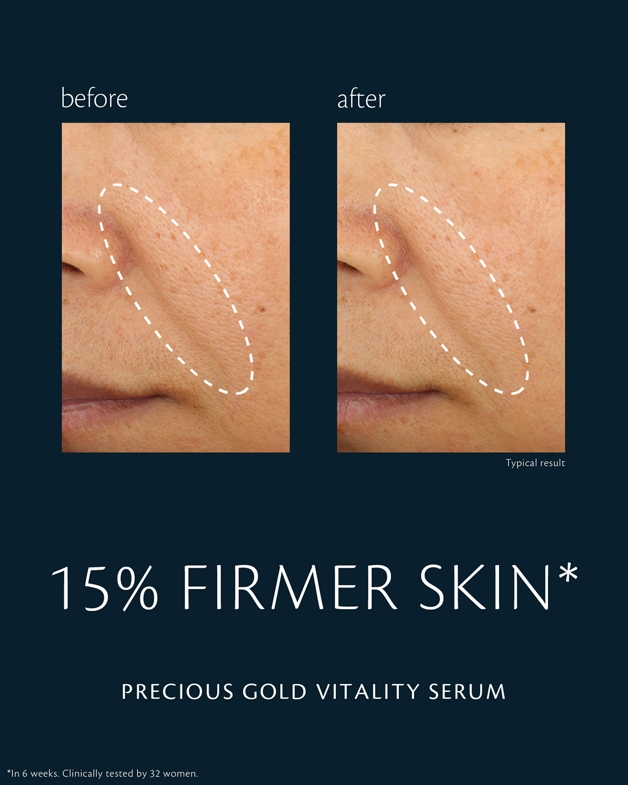 Photo of before-and-after comparison of skin using "PRECIOUS GOLD VITALITY SERUM." In the “before” image (left), skin firmness on the cheek appears diminished; in the “after” image (right), firmness is improved by 15%. Clinical test conducted over 6 weeks with 32 women.