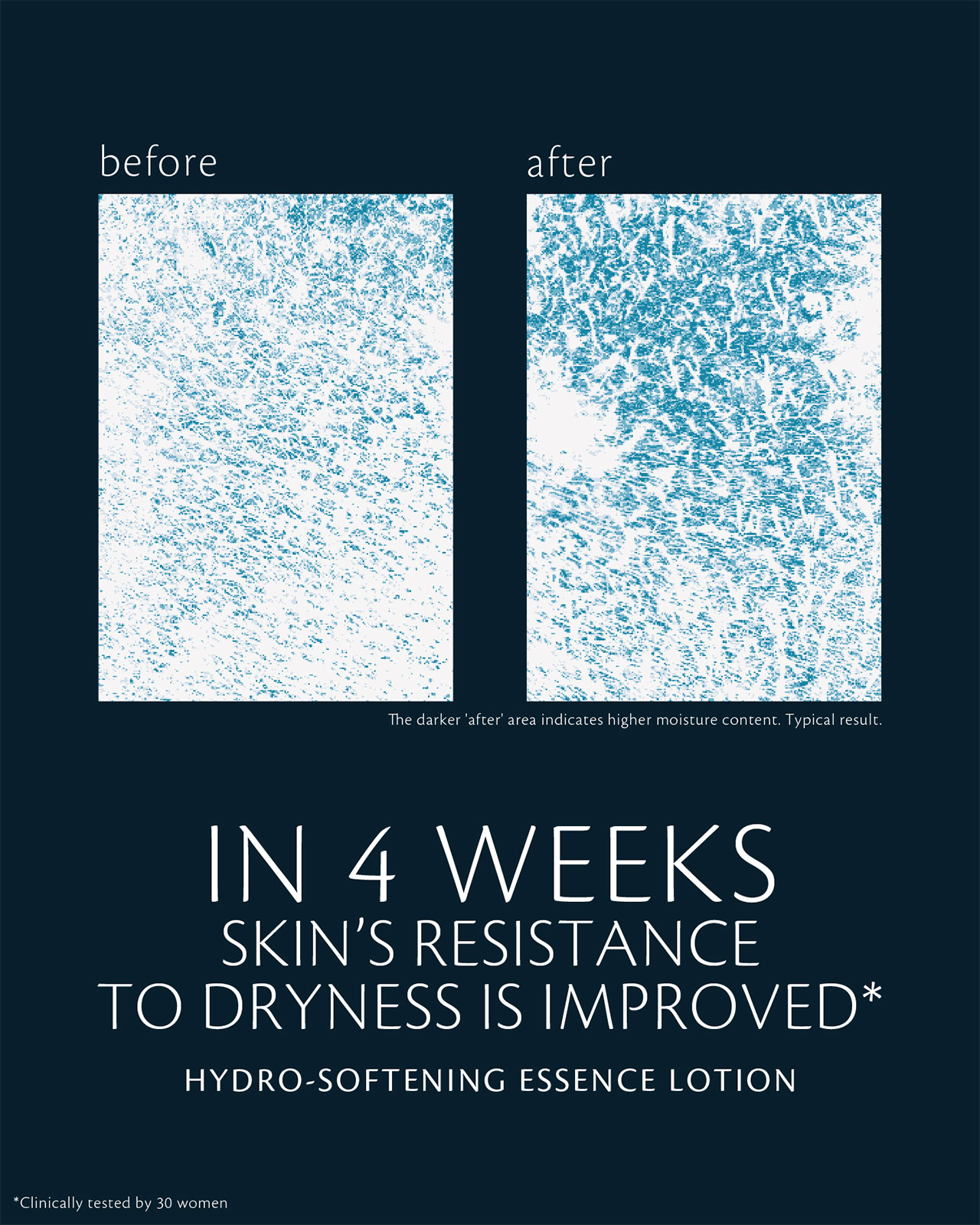 Photo of clinical test results for HYDRO-SOFTENING ESSENCE LOTION on 30 women, showing improved resistance to dryness after 4 weeks. The “before” image shows lower moisture content, and the “after” image shows darker areas indicating higher moisture content.