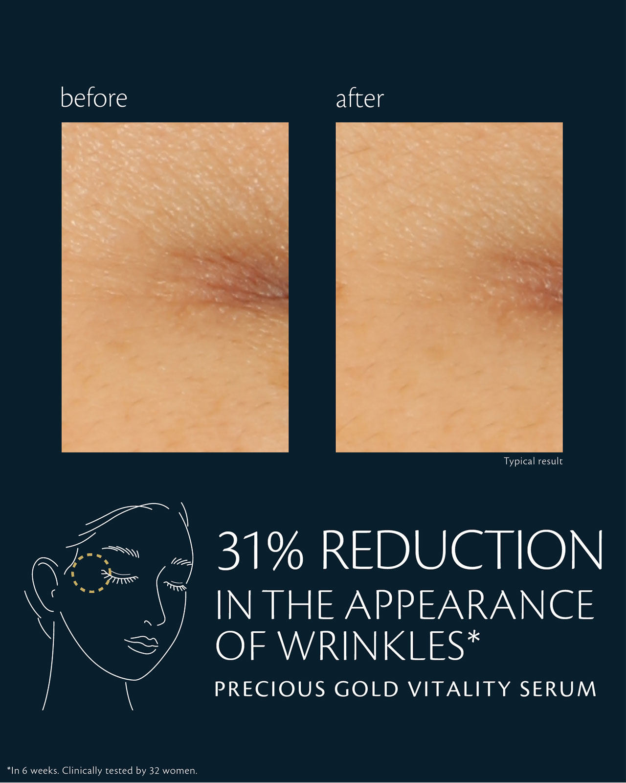Photo of before-and-after comparison of skin using "PRECIOUS GOLD VITALITY SERUM." In the “before” image (left), crow’s feet are more visible; in the “after” image (right), the appearance of wrinkles is reduced by 31%. Clinical test conducted over 6 weeks with 32 women.
