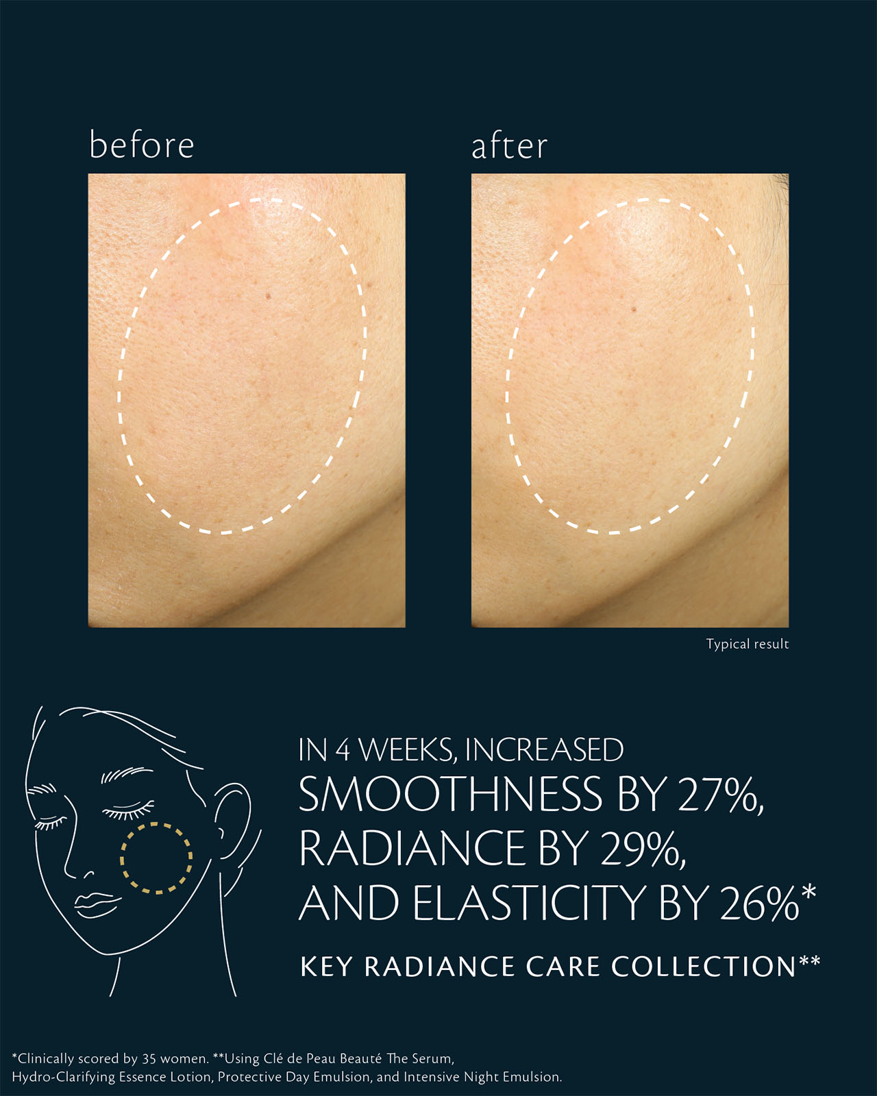 Photo of before-and-after comparison of skin condition with KEY RADIANCE CARE COLLECTION.The left image shows the cheek area before use, with visible dryness and uneven texture. The right image shows the cheek area after 4 weeks of use, with smoothness improved by 27%, radiance by 29%, and elasticity by 26%, based on a clinical test of 35 women.