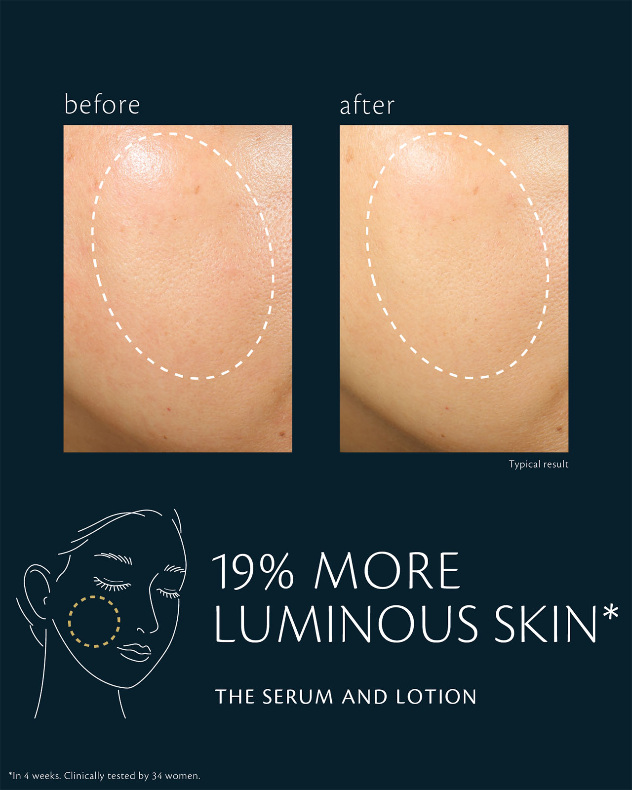 Photo of a before-and-after comparison showing changes in skin brightness from combined use of THE SERUM AND LOTION. The left shows before use, and the right shows after use, with increased brightness and radiance in the circled cheek area. Clinical test results show a 19% improvement in skin radiance after 4 weeks.