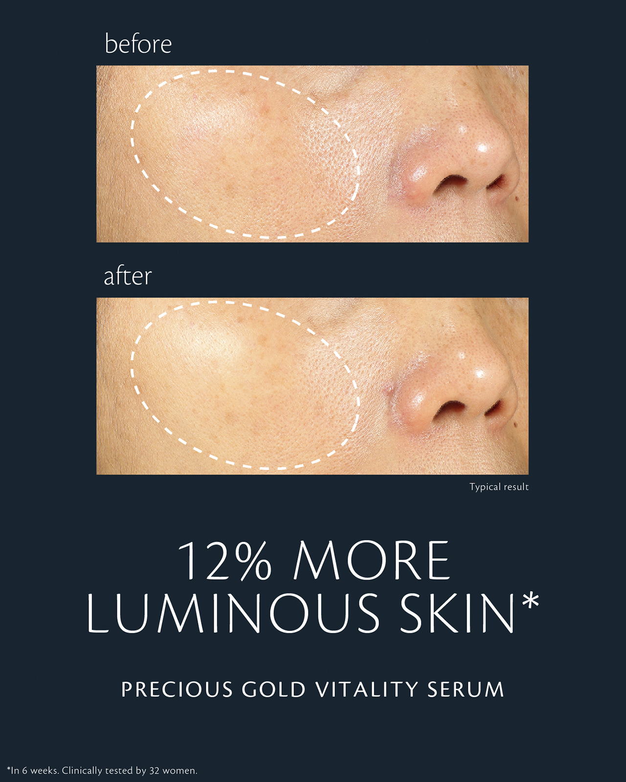Photo of before-and-after comparison of skin using "PRECIOUS GOLD VITALITY SERUM." In the “before” image (top), skin appears less radiant; in the “after” image (bottom), radiance is improved by 12%. Clinical test conducted over 6 weeks with 32 women.